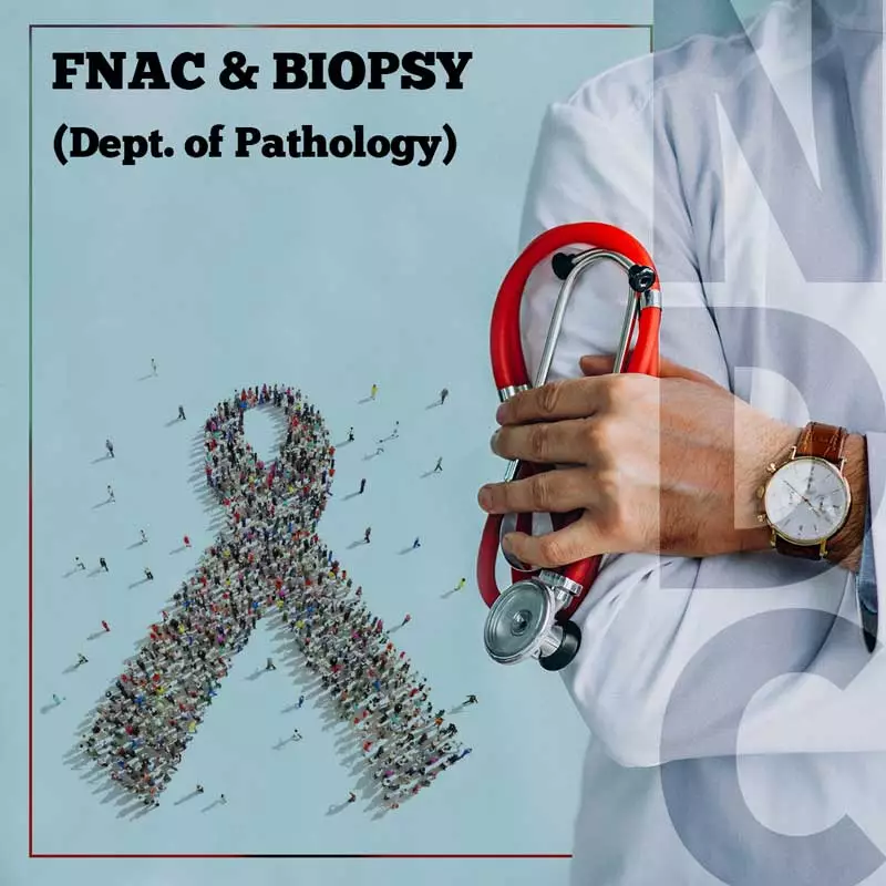 FNAC--BIOPSY-NorthCityCiagnostic-Centre