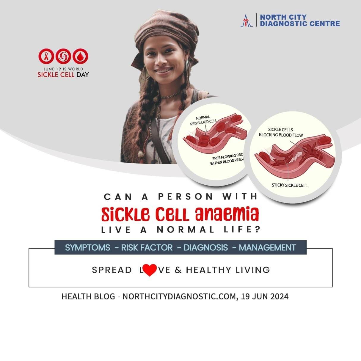 Can-a-person-with-sickle-cell-anaemia-live-a-normal-life---Health-blog---North-city-diagnostic