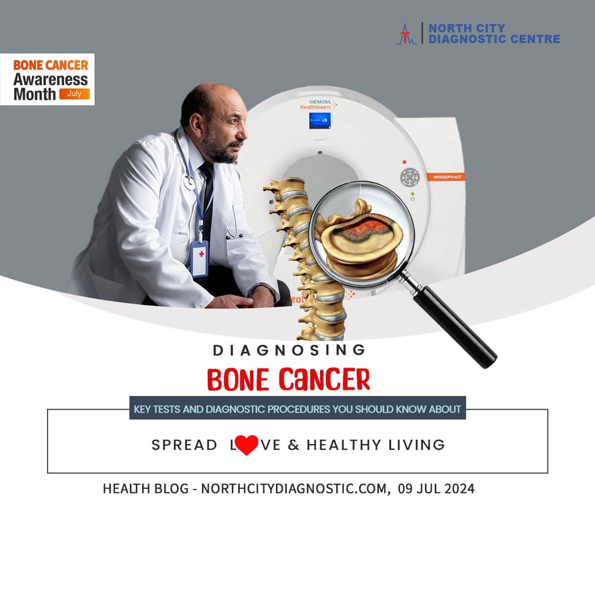 Diagnosing-Bone-Cancer--health-blog---NDC---North-City-Diagnostic-Centre