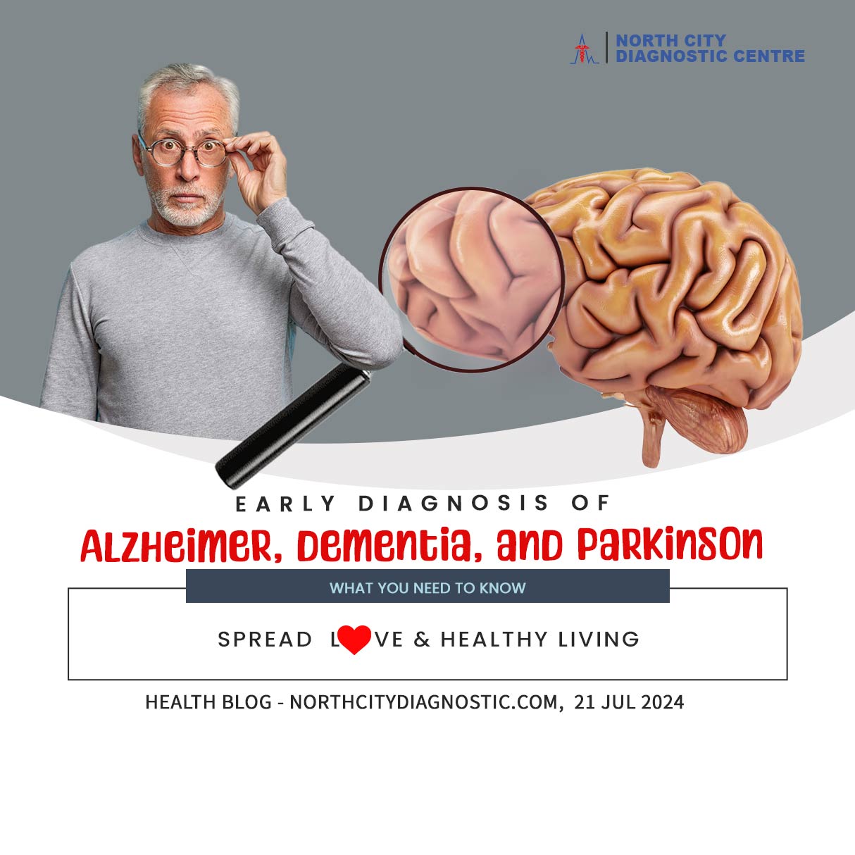 Early-Diagnosis-of-Alzheimer,-Dementia,-and-Parkinson--health-blog---NDC---North-City-Diagnostic-Centre