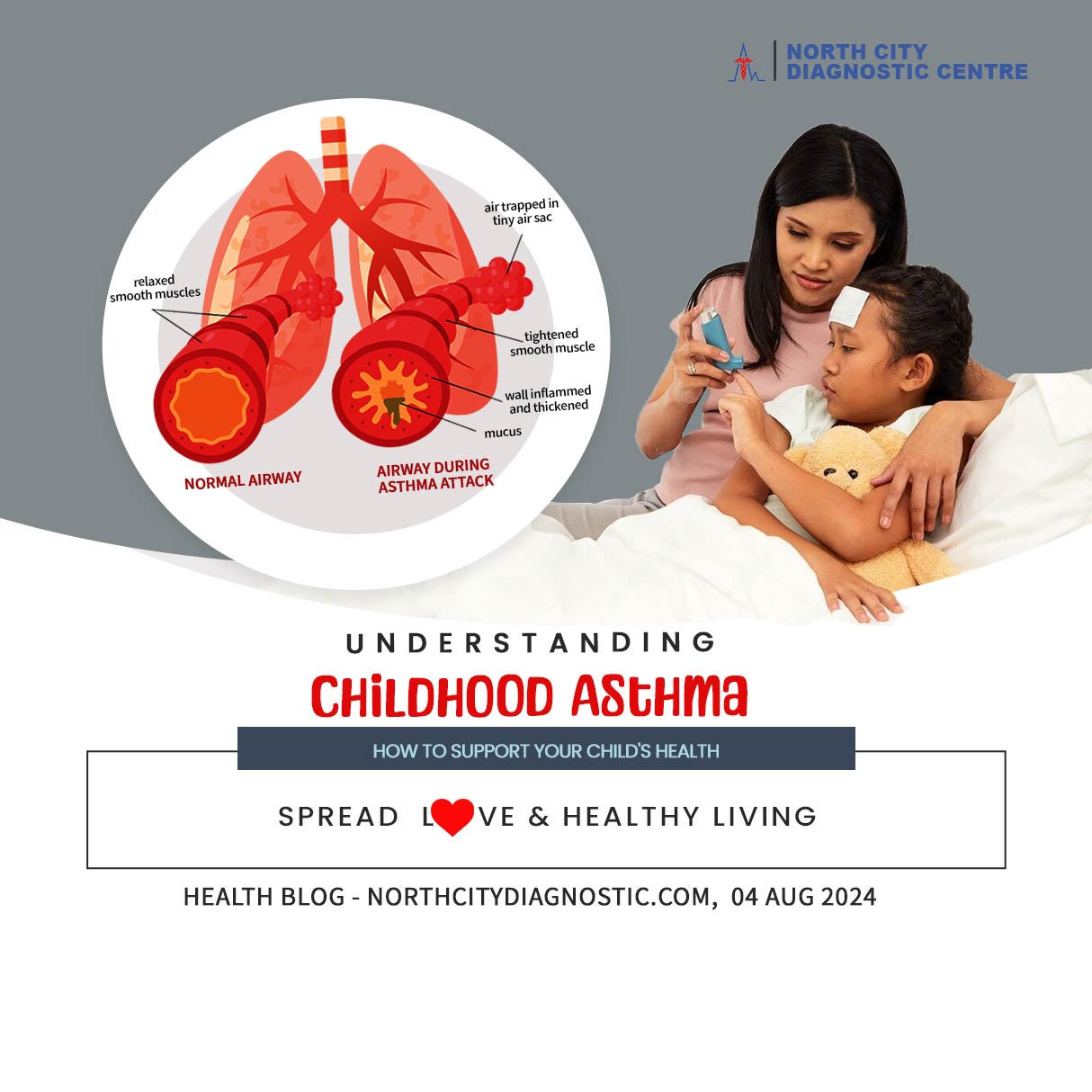 Understanding-Childhood-Asthma--health-blog---NDC---North-City-Diagnostic-Centre