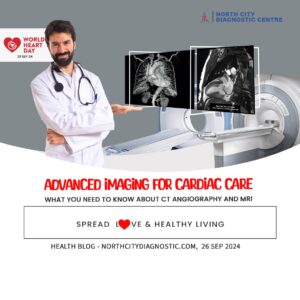 Advanced-Imaging-for-Cardiac-Care--health-blog---NDC---North-City-Diagnostic-Centre